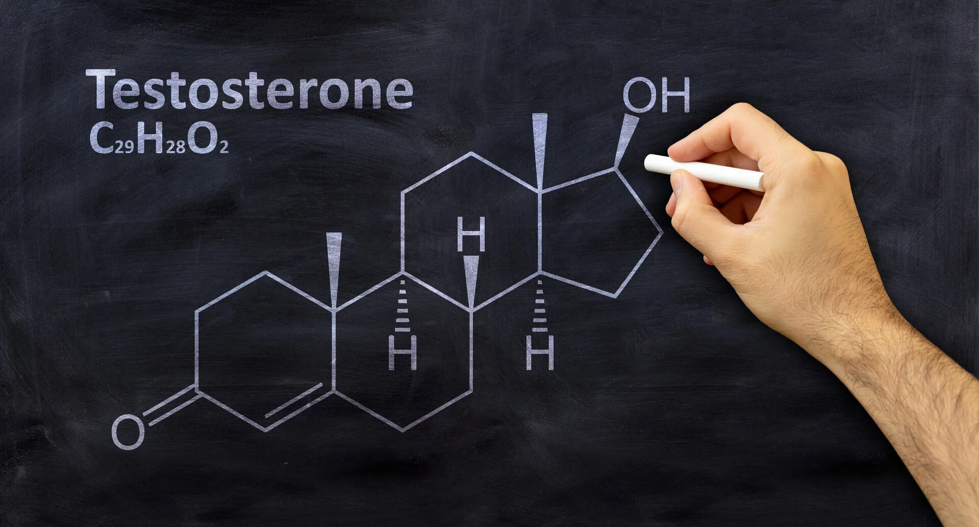 High Testosterone in Women: Causes, Symptoms, and Evidence-Based Treatment (2026)